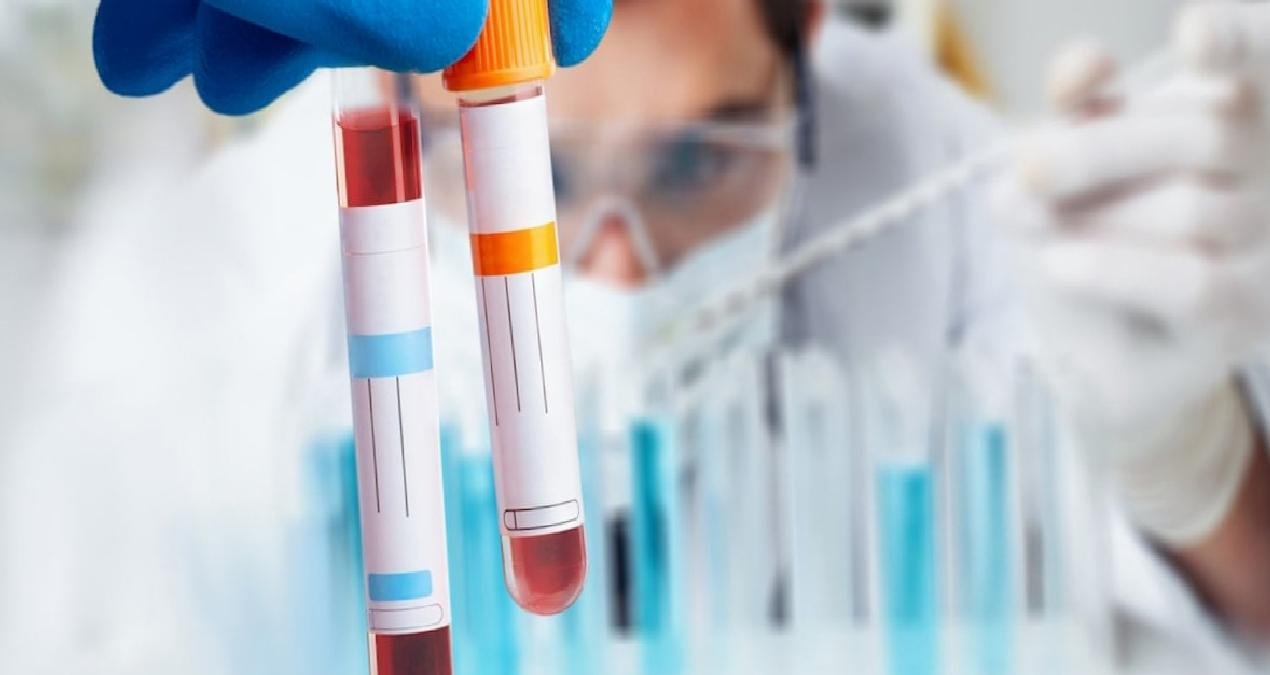Hatırlamak için yeni umut: Bu test her şeyi değiştirebilir! – CİSAMER